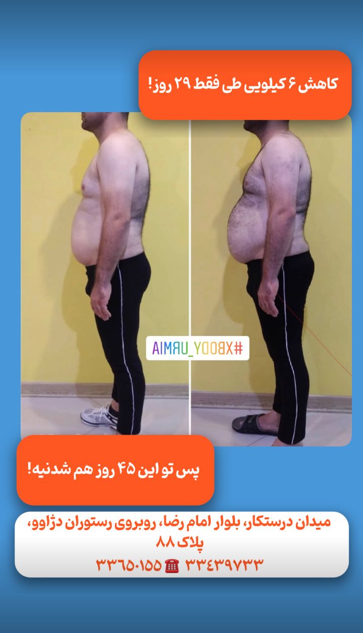چربيسوزى و عضله سازى